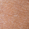 dehydrated skin texture