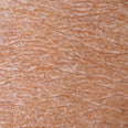 dehydrated skin texture