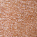 dehydrated skin texture