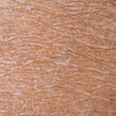 dehydrated skin texture