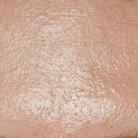 Oily skin texture