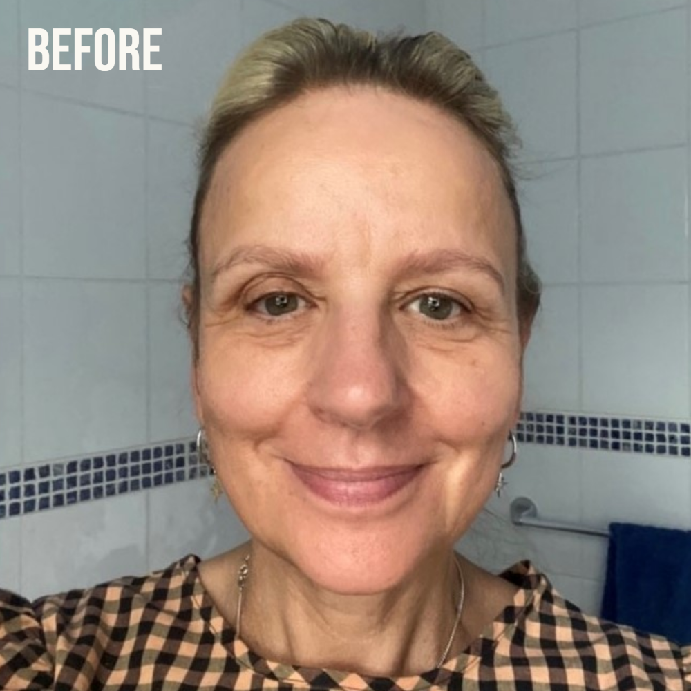 Retinol Fix Fine Lines & Wrinkle Routine Kit for Skin With Signs of Ageing