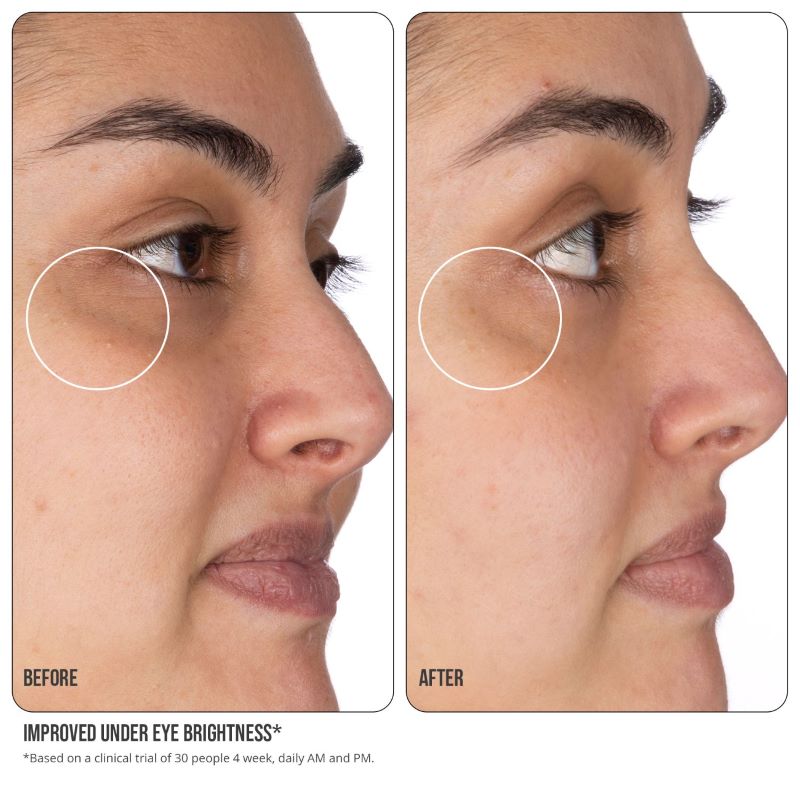 Vitamin c shop under eyes
